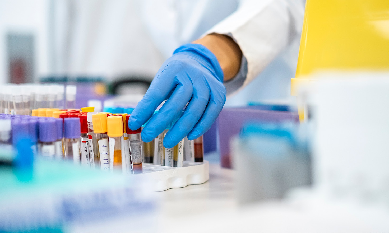Scientist's gloved hand selects blood samples