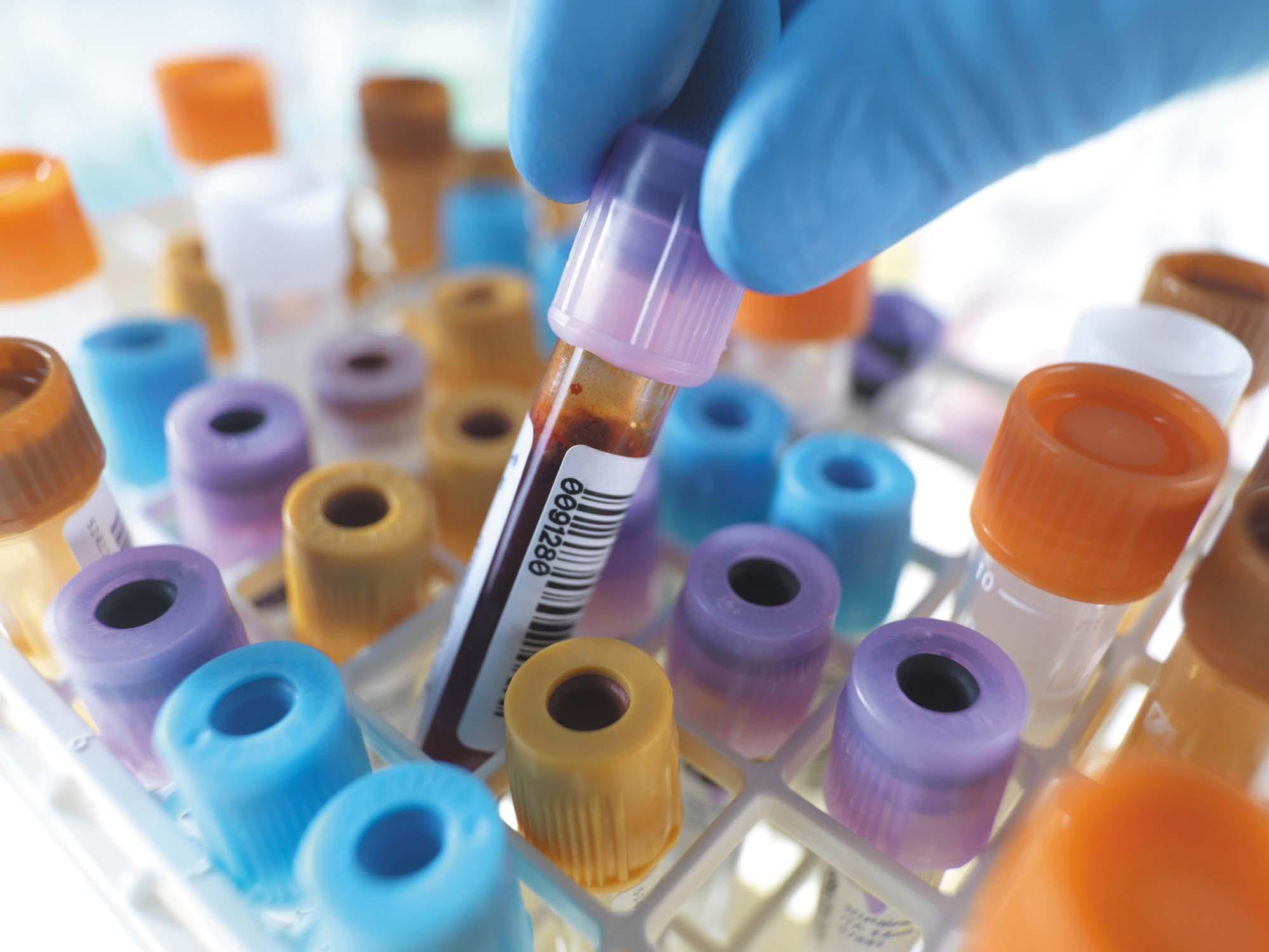 Close-up of a group of blood test tubes with assorted color caps; a gloved hand is removing a tube filled with blood from the stand.
