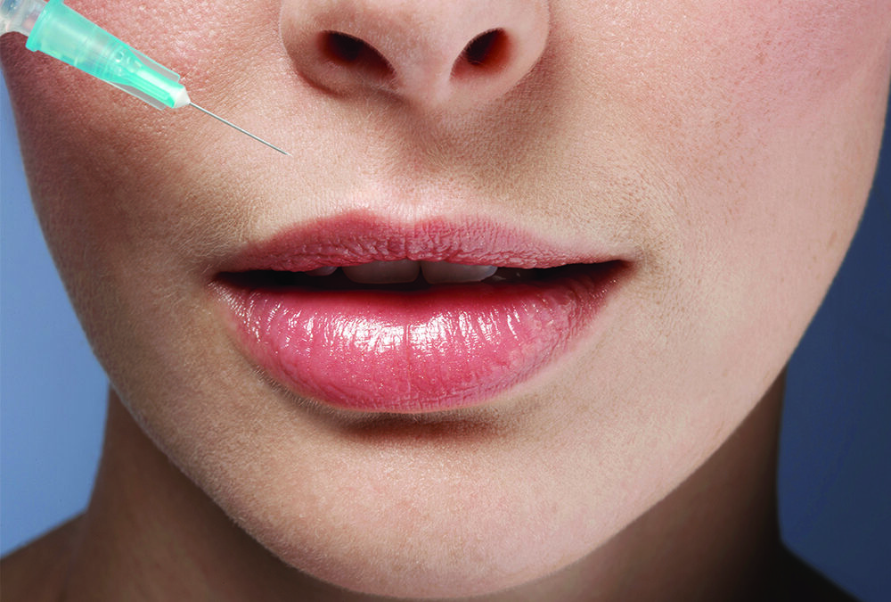 The Truth About the “Natural” Biostimulatory Filler Trend