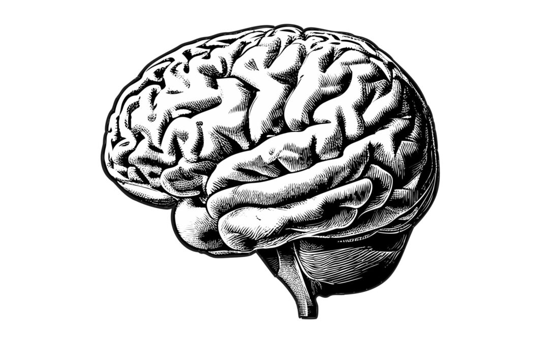 CJD diagnostic criteria | Classic CJD