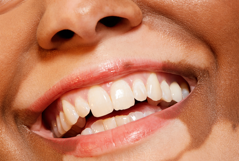 Garlic Mouthwash Shows Promise as a Natural Oral-Care Option