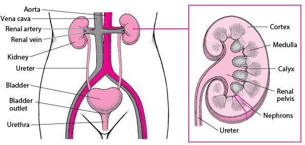Urethra defects – children’s health problems