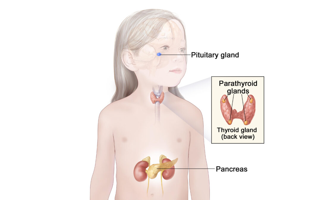 Childhood MEN1 Syndrome – NCI