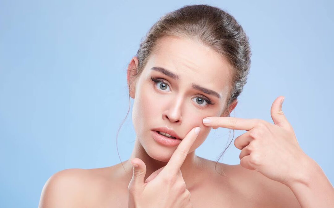 Understanding the link between skin health and hormonal balance