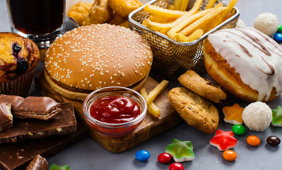 Metabolic dysfunction-associated steatotic liver disease (MASLD)