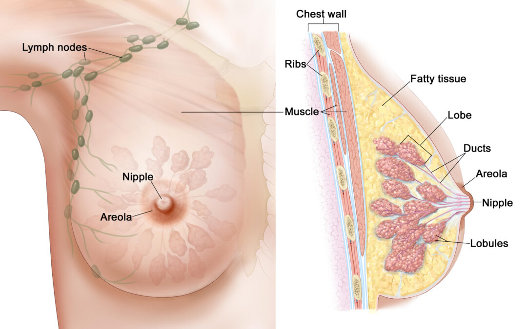 What is breast cancer? – NCI